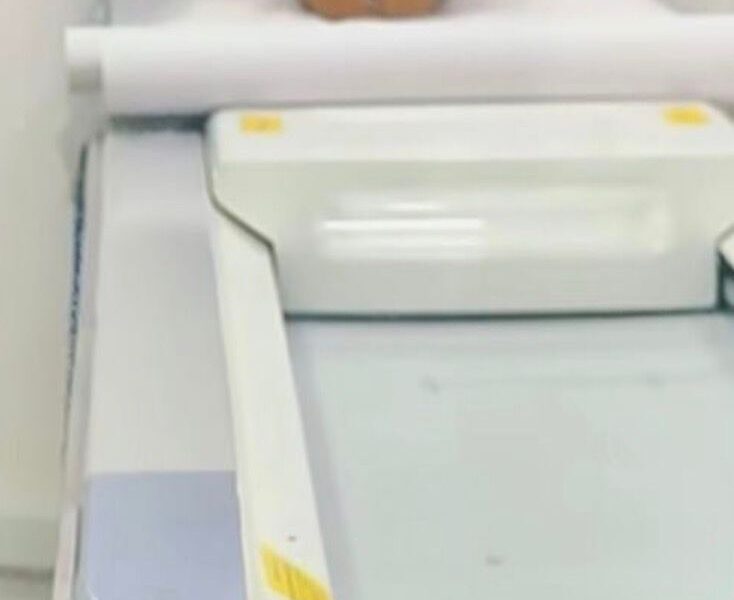 Tomógrafo móvel está em São José de Ubá